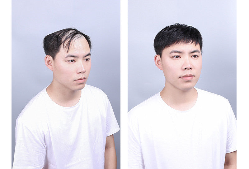 Men's Hair Replacement Forehead Bald Flip Cover